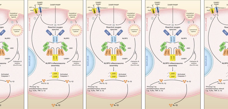 RA Is a Syndrome, NOT a Single Disease
