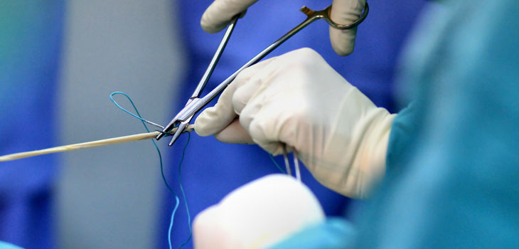 New Study: Autografts Last Longer for ACL Reconstruction