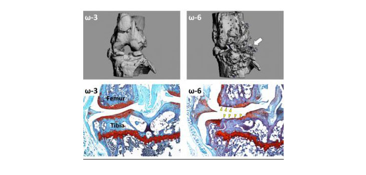 Duke Research: Omega 3 Fatty Acids May Help OA