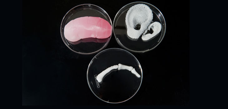 3-D Bioprinting Directly Into Wounds!