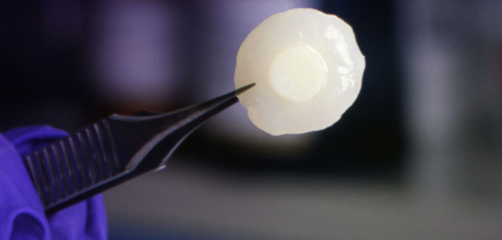 China Tests Report Cartilage Regrowth