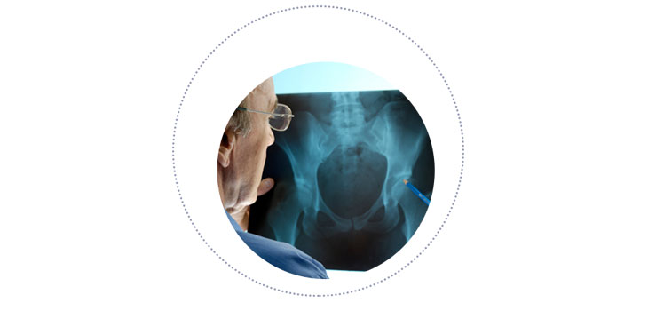 Intellijoint Surgical: FDA Clearance for Intellijoint HIP