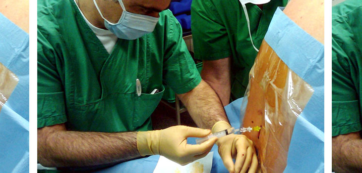 Regional Anesthetic Cuts Hospital Stays by a Third