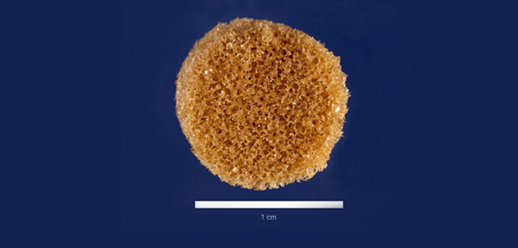 New Shape-Memory Polymer Molds to Shape of Bone Defect