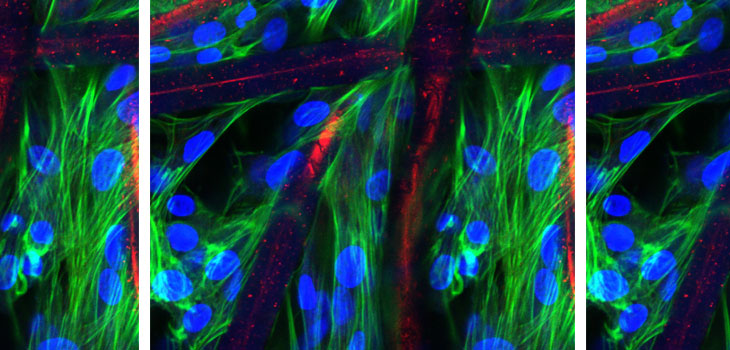 Pluristem Therapeutics: Approval From Israeli Ministry of Health