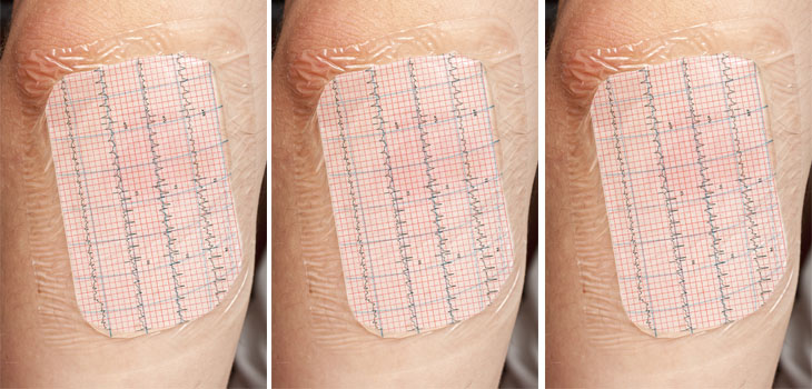 Smart Bandage Monitors Vital Signs