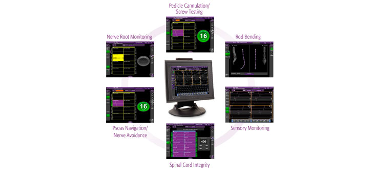 NuVasive Announces Nerve Monitoring Technology