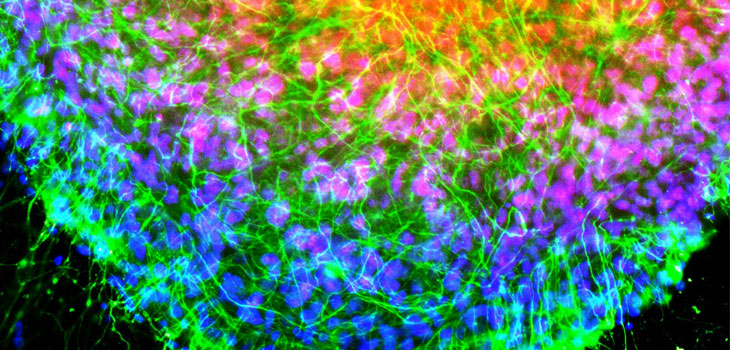 Spinal Cord Cells Created In Petri Dish