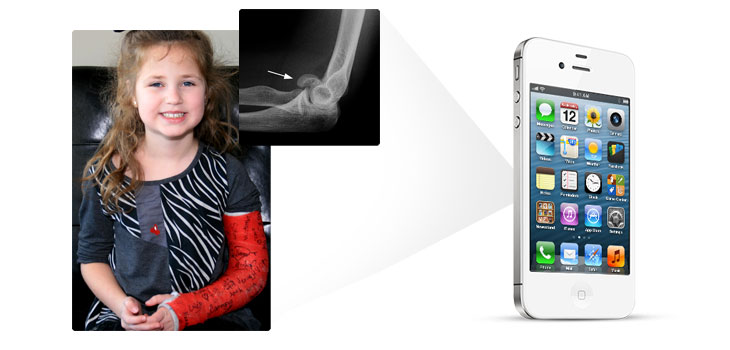 AAOS: New Criteria, App for Pediatric Elbow Fractures
