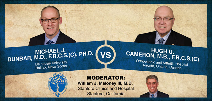 Dunbar, Cameron Debate Modular Necks