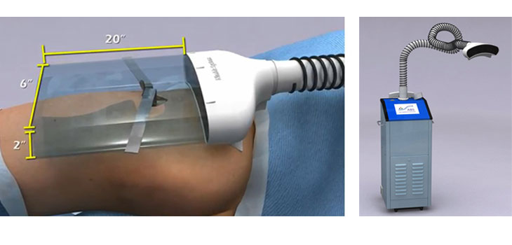 $1.5 Million to Study Anti-Infection Device