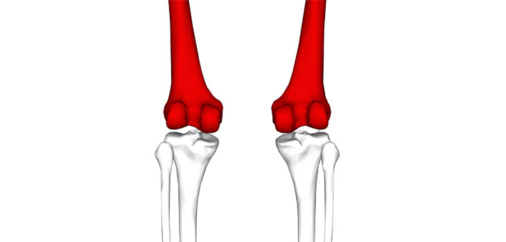 3-D Knees Growing in Popularity
