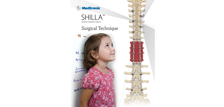 FDA Cleared System Spares Scoliosis Kids From Fusion