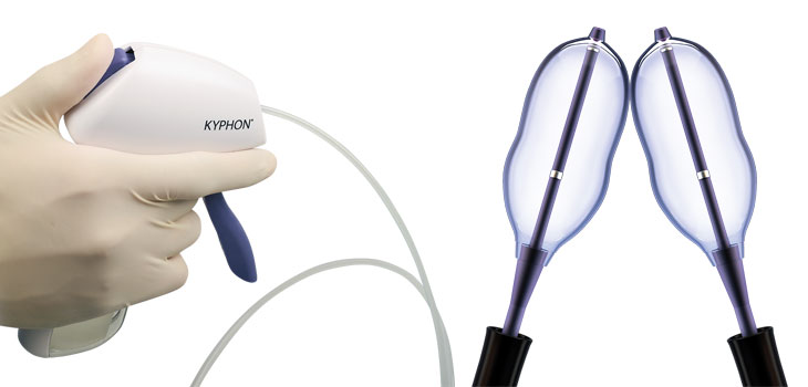 Medtronic’s Next Generation Kyphon System