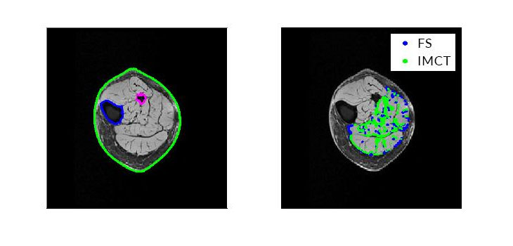 Engineers Simulate Skeletal Muscle Tissue With Pixels
