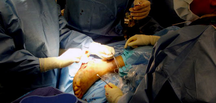 Ankle Replacement Prime Treatment for Pain
