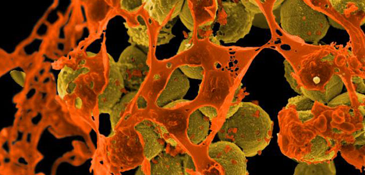 Infection Progress From TJU, NIH