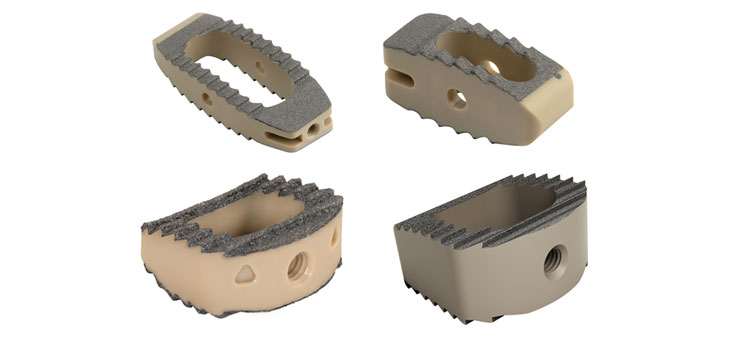 Medtronic Coats Titanium to PEEK for New Spine Implants