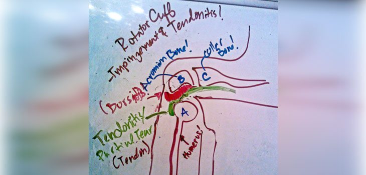 Rotation Medical Initiates Rotator Cuff Study