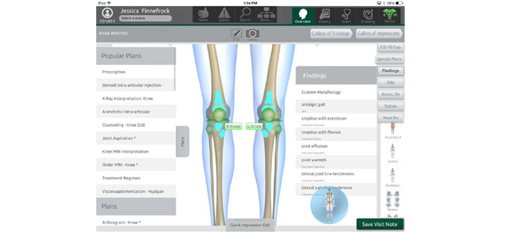 MRI From Your Smartphone? Auto Billing When You Step Out of the Exam Room? Yes! // New HSS Study to Tackle Critical ACL, UCL Failure Issue // and More!