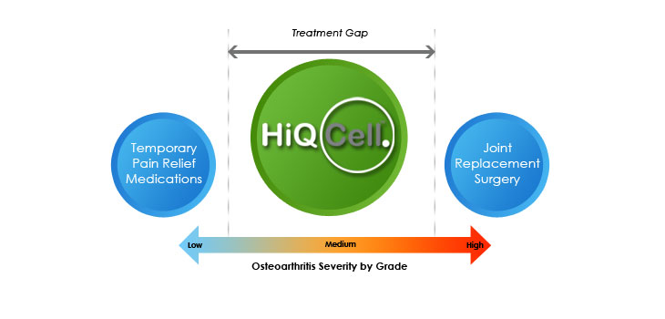 Stem Cell Company Targets OA Knee Treatment Gap