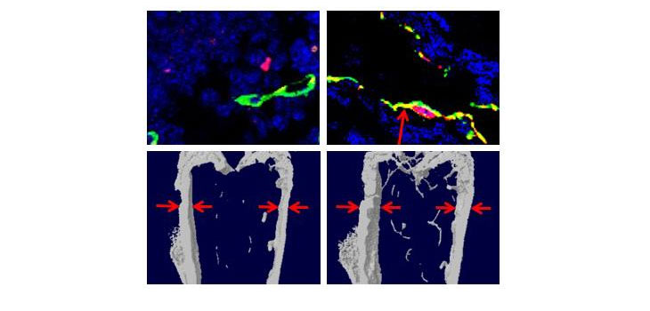 Overlooked Cells May be Clue to Osteoporosis