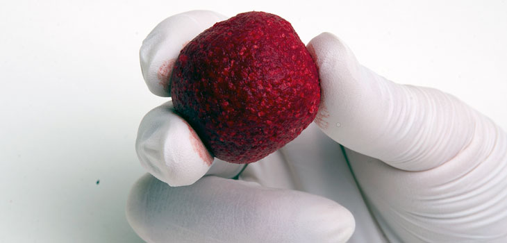 NovaBone Ups the BioGlass Ante With Two New Products