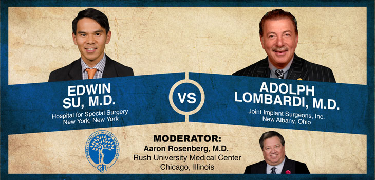 Su v. Lombardi: Yay or Nay to Metal-on-Metal Surface Replacement?