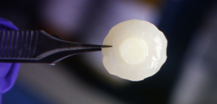 Cartilage Cure Goal of Landmark Alliance