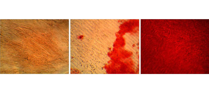 Novel Way to Get Bone-Producing Cells From Fat