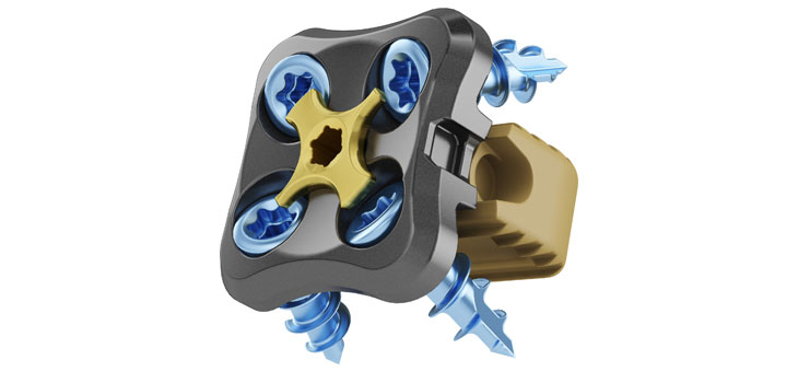 Medtronic Claims Better Anterior Cervical Fusion System