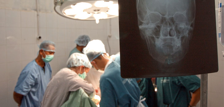 Mini-Knee Implants Repair Fused Jaw