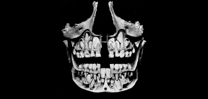 Stem Cells Enable Jaw Regeneration
