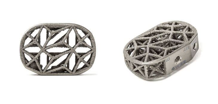 4WEB Medical Reaches 3, 000 Implant Milestone