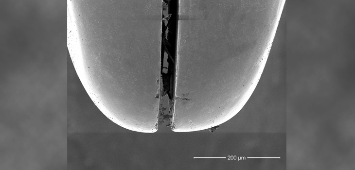Tehran Researchers Invent Novel Maxillofacial Implant Alloy