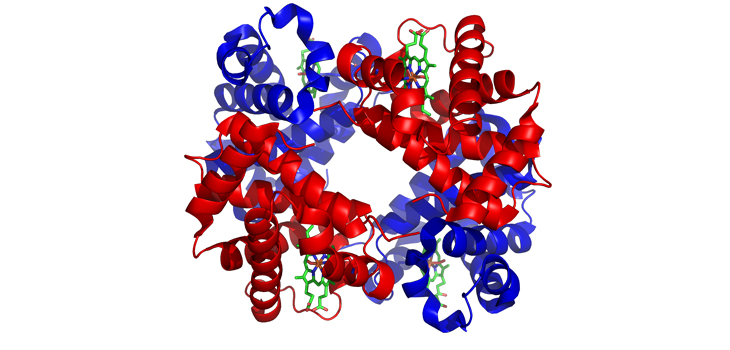 Metal/Plastic Generated Metal Ions Culprit in Unexplained Post-Op Pain // Pre-op Hemoglobin Guards Against Infection?! // and More!