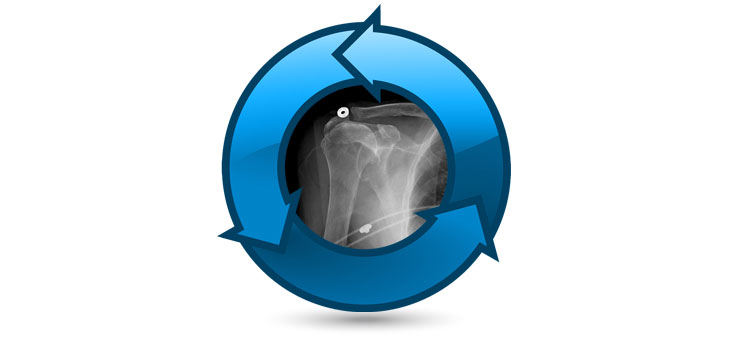 New Harvard Study Could Change Orthopedics Forever // Which Spine Surgery LEAST Likely to Repeat? Riew and Hilibrand Tackle Question // and More!