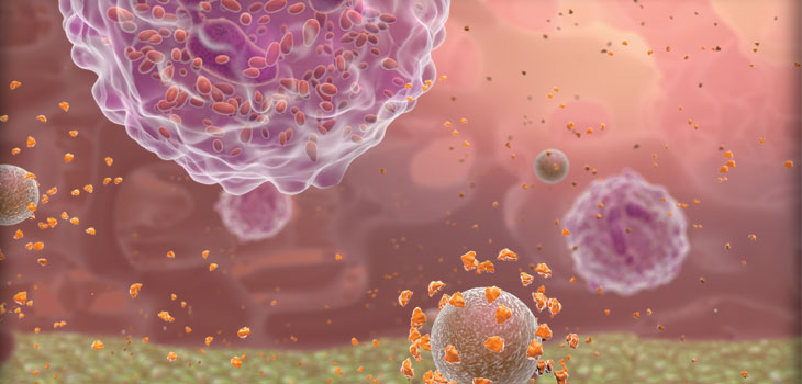 Zimmer’s Periprosthetic Joint Infection Test Available in Europe