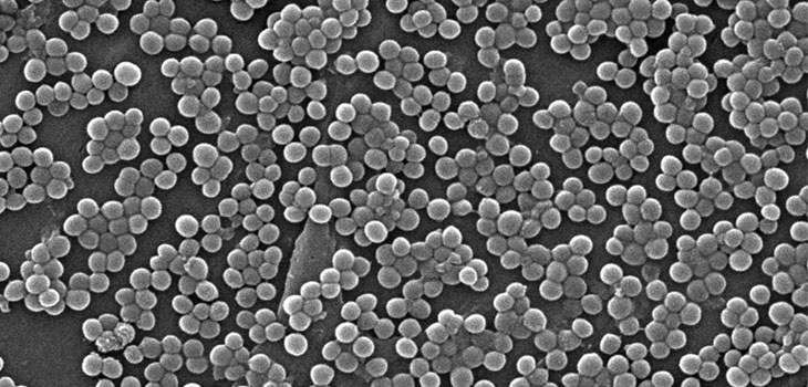 NIH Grant to Fight Joint Infections