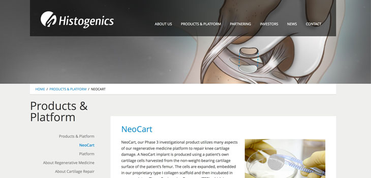 Histogenics Is Public – Regenerating Cartilage