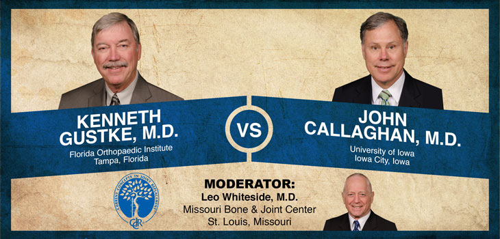 Gustke Debates Callaghan: Ultracongruent Liners or Posterior Stabilization