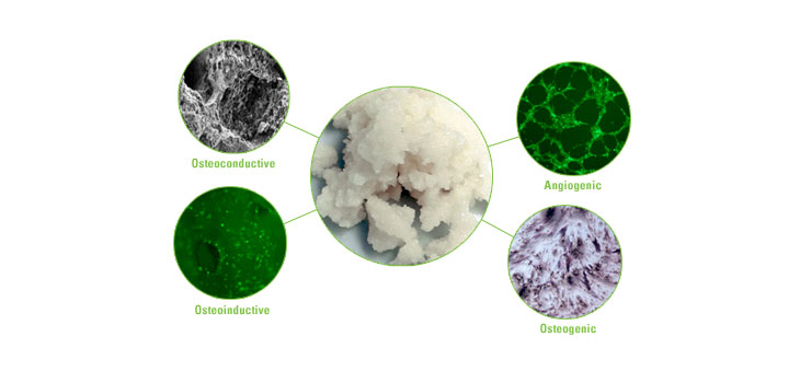 Stryker Gets Exclusive Rights to Osiris Bone Allograft