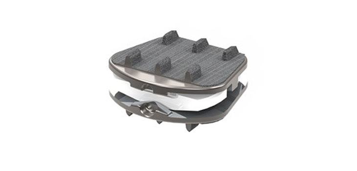 Synergy Claims Its Cervical Disc Is World’s First