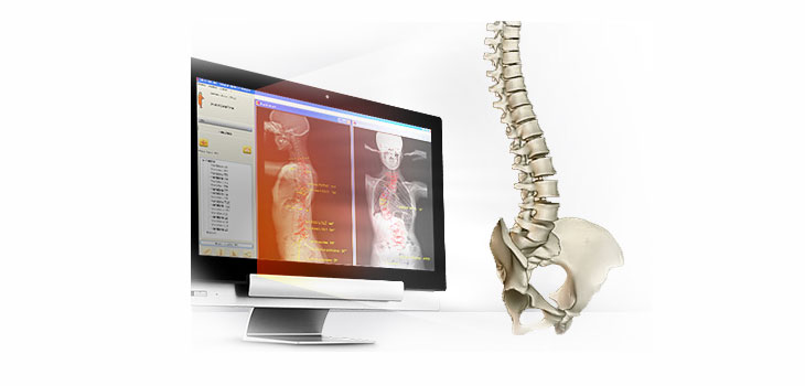 FDA Approves 3D Hip Arthroplasty Software