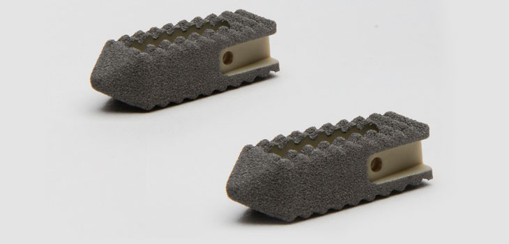 New Interbody System From Aesculap