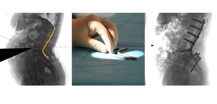 FREE Software Accurately Predicts Surgical Outcomes 97% of the Time // 86% of Soldiers Return to Duty After Joint Surgery // and More!