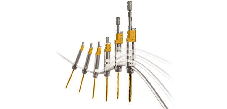K2M’s Newest Pedicle Screw System Cleared for Marketing