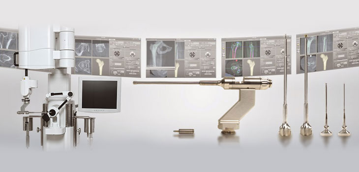FDA Clears Think Surgical’s 3D Workstation