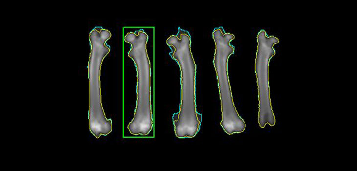 Life Satisfaction=Higher Bone Density