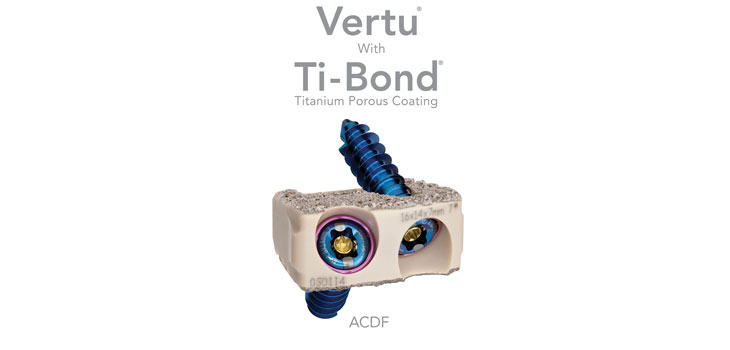 Spinal Elements Gets FDA Clearance for Devices With Ti-Bond